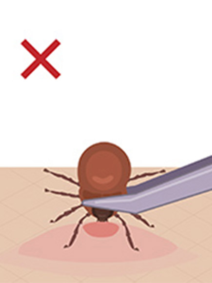 вытащить клеща