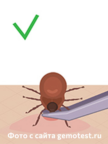 как достать клеща